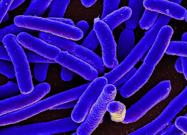 Trên thực tế, siêu vi khuẩn với khả năng kháng colistin không phải được phát hiện lần đầu tiên trên thế giới.