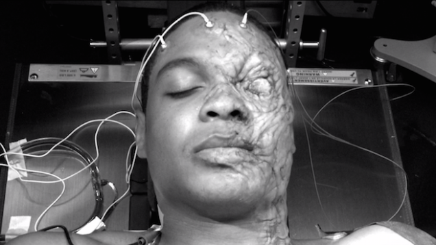 
Khuôn mặt của Cybork lúc này đã được xử lý qua CGI để tạo nên các mô sẹo.
