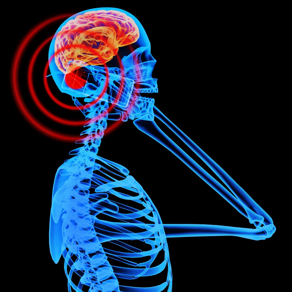  Bức xạ điện thoại có thể gây tác hại nhất định đến não bộ 