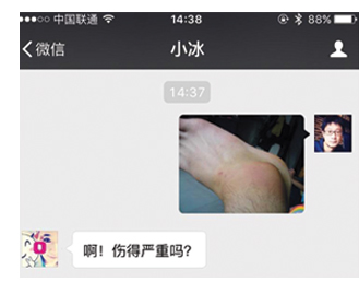  Khi Xiaoice nhận được một bức ảnh mắt cá chân bị sưng, cô ấy đã cho thấy sự quan tâm của mình. Câu đáp trả được dịch ra là “Eo! Vết thương của anh có nặng không vậy?” 
