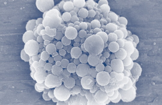  Các nhà khoa học muốn tạo ra bong bóng mang thuốc đến khối u 