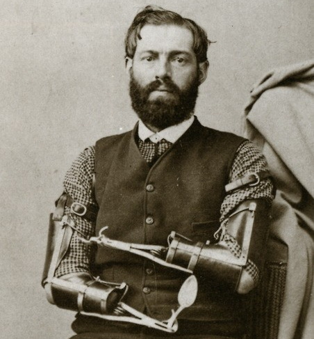  Cánh tay của Samuel Decker năm 1865 có thể gọi là ông tổ chi giả robot hiện đại 