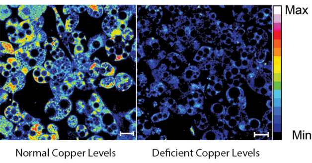  Hình ảnh chỉ ra sự khác biệt giữa tế bào chất béo trắng có đồng và thiếu đồng 