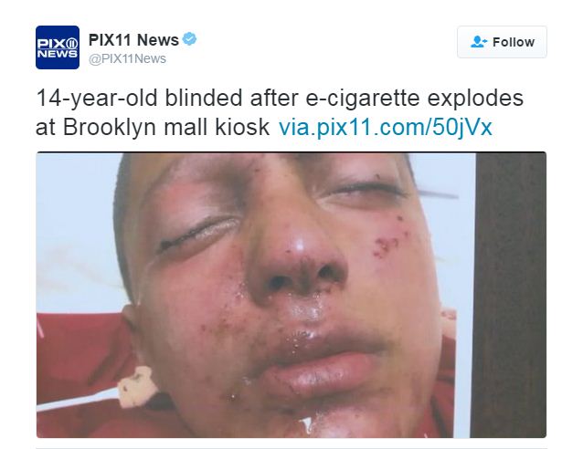 Cậu bé 14 tuổi bị mù một bên mắt khi thiết bị hút thuốc điện tử phát nổ ngay tại quầy bán.