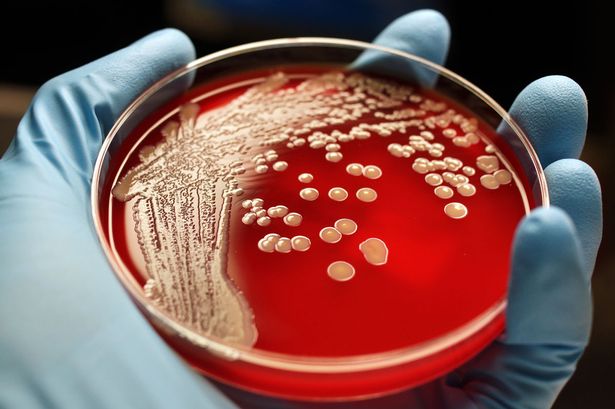 Siêu vi khuẩn đang là nỗi lo của rất nhiều người trên thế giới