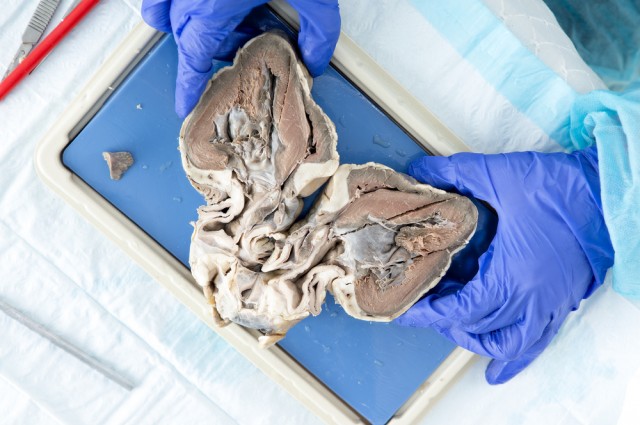  Những quả tim lai tạo được cấy ghép trên một số động vật có thể trở thành cứu cánh cho không ít bệnh nhân. 