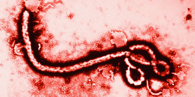  Hình ảnh virus Ebola dưới kính hiển vi. 