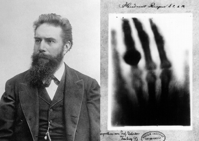 8/11/1895 - Wilhelm Conrad Röntgen tình cờ phát hiện ra tia X