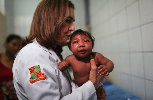
Virus Zika đang bị nghi ngờ là nguyên nhân gây hội chứng đầu nhỏ ở trẻ sơ sinh. Ảnh: TL

