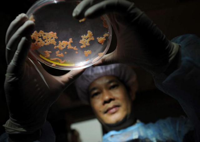  Bác sĩ Thắng cầm một mẫu mô màng rốn được sử dụng để tách ra các tế bào gốc (Ảnh The Straits Times) 