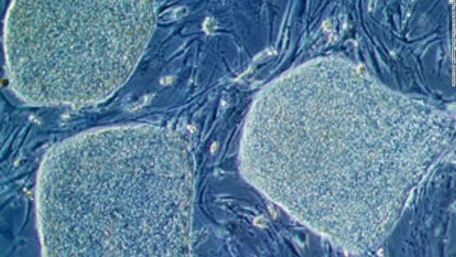  Tế bào gốc là một hướng nghiên cứu phát triển rất mạnh trong y học 