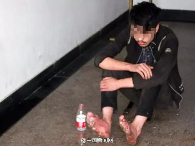 
Cậu thanh niên nghiện game với đôi chân bị thối rữa sau 6 ngày cắm rễ ở quán net.
