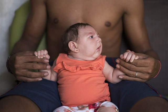  Virus Zika bị nghi có mối liên quan đến chứng não nhỏ ở trẻ sơ sinh. 