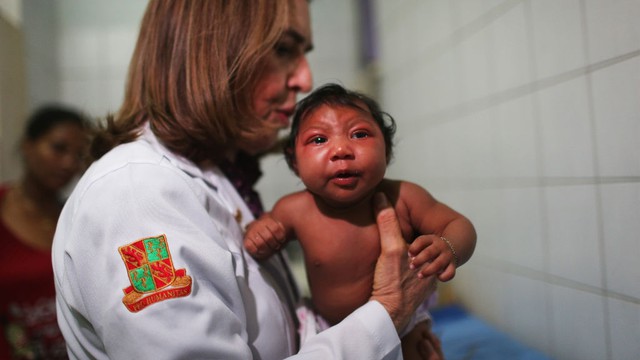  Virus Zika là nguyên nhân cho chứng nhỏ đầu của trẻ sơ sinh khu vực Nam Mỹ 