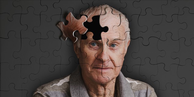  Bệnh nhân HIV ngày nay đã sống đủ lâu để mắc Alzheimer 