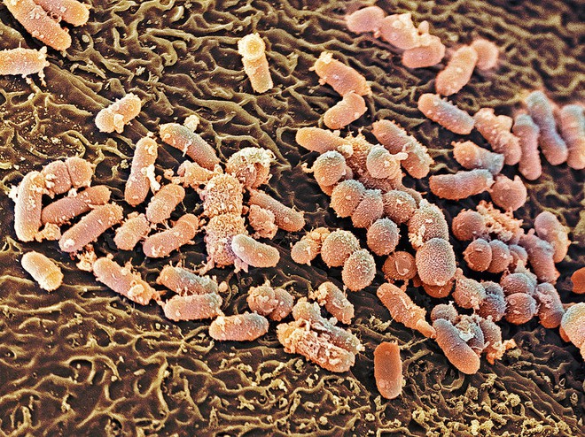  Hàng tá vi khuẩn sống trên các tế bào bên trong mũi bạn 