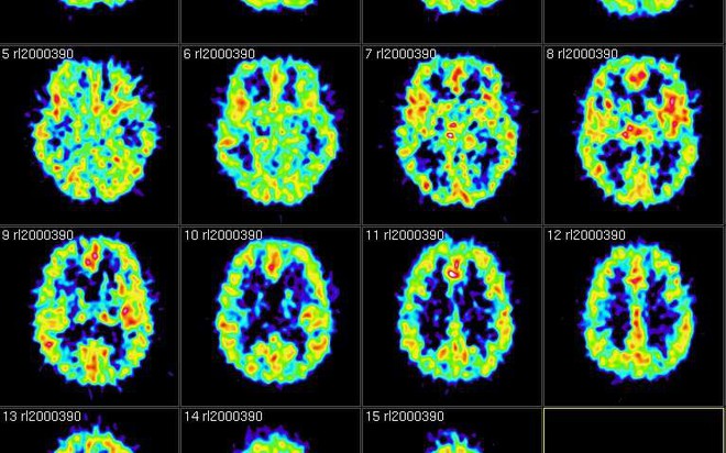  Hình ảnh chụp cộng hưởng từ MRI não bộ người tham gia thử nghiệm. 