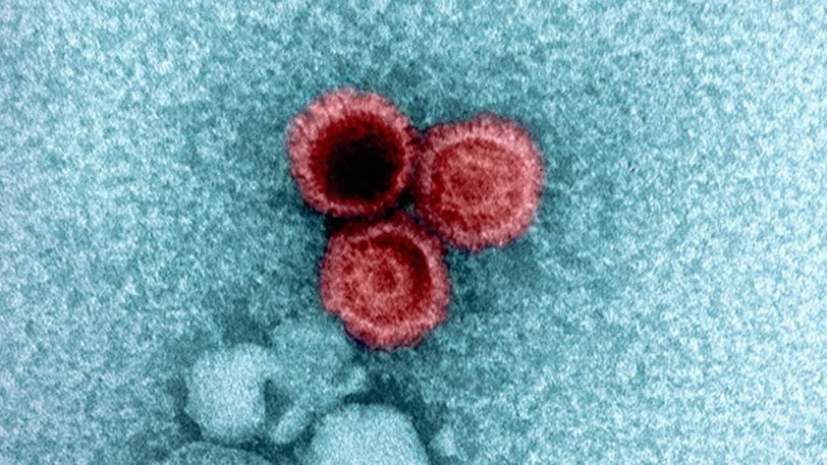 Tại sao một số virus lại tồn tại ở trạng thái ngủ đông trong cơ thể người suốt đời?