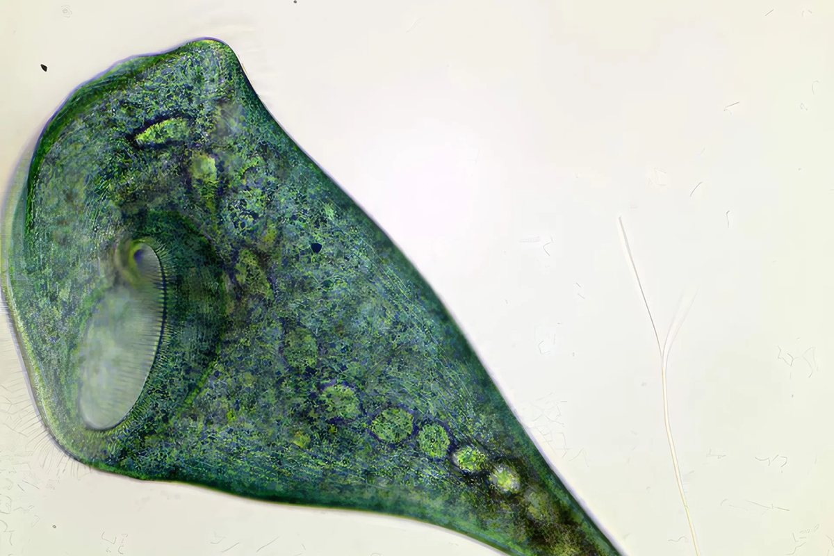 Sinh vật đơn bào Stentor coeruleus chứng minh rằng học hỏi có thể không cần dùng tới não