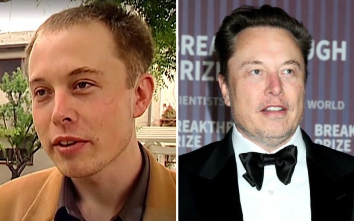 Bệnh hói đầu sắp ”tuyệt chủng” đến nơi: Huyết thanh từ thực vật giúp tóc dày lên 25% chỉ trong 56 ngày