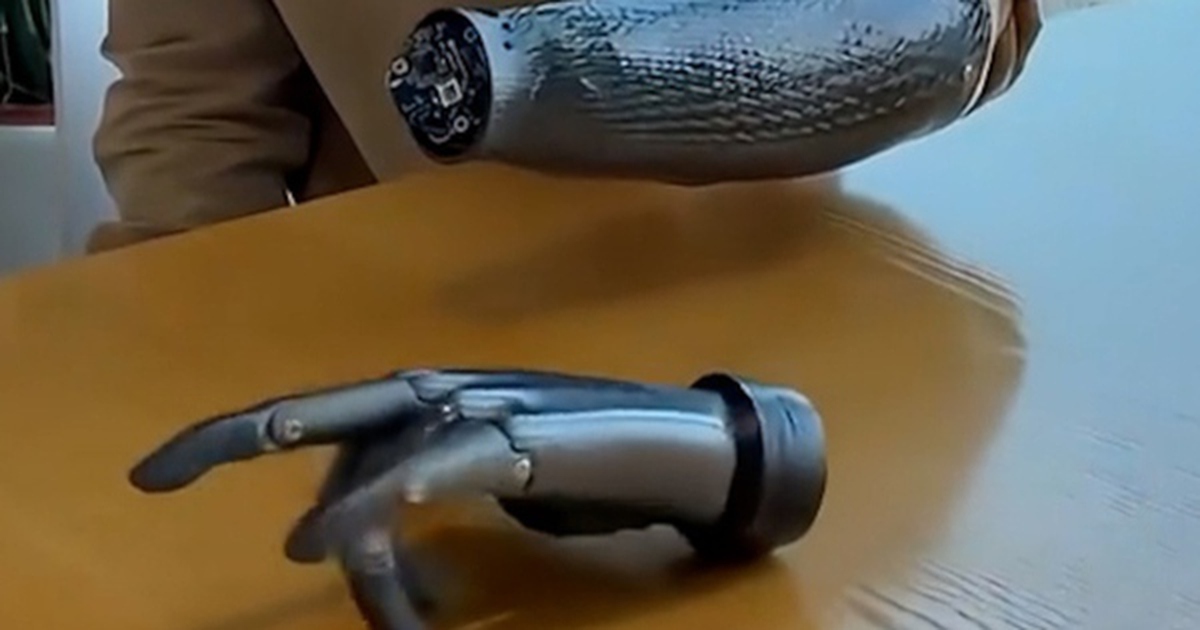 Trung Quốc lại một lần nữa khiến cả thế giới bất ngờ với cánh tay giả có thể "đọc" suy nghĩ và di chuyển linh hoạt ngay cả khi không kết nối với cơ thể người!