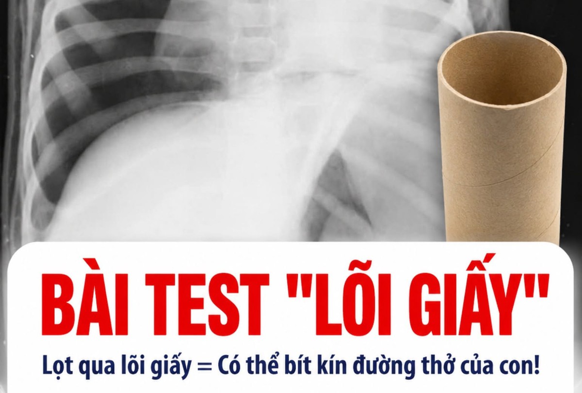 BS chuyên khoa Nhi tiết lộ: Chỉ bằng bài kiểm tra với lõi giấy vệ sinh, cha mẹ có thể ngăn con hóc dị vật
