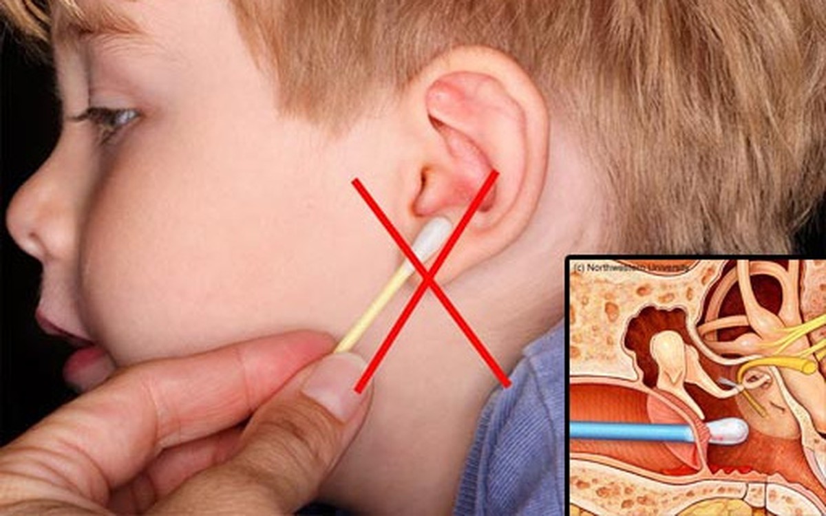 4 lỗi lầm thường mắc phải khi vệ sinh tai