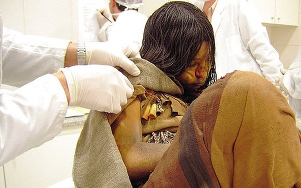 The girl’s body, buried 500 years ago, still had her organs intact, her skin was still elastic as if she was sleeping, opening an unexpected discovery of the scientific world.