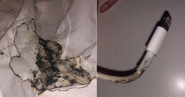 iPhone caught fire while plugged in on a bed, a teenager burned his face