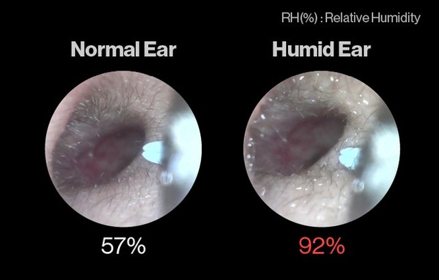 Đeo tai nghe nhiều bị ngứa, đau hay nhiều ráy đã có giải pháp: Máy hút ẩm cho tai, đeo 3 phút là khô thoáng, mua sớm giảm 43% - Ảnh 1.