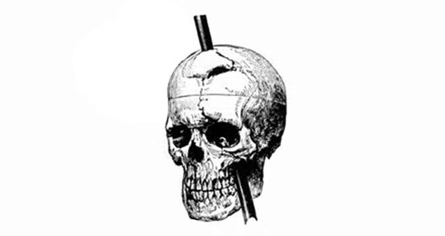 Phineas Gage và vụ tai nạn đã khai sinh ra khoa học thần kinh hiện đại - Ảnh 2.