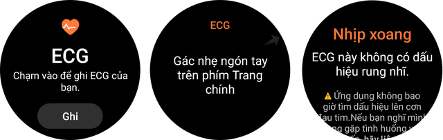 Điện tâm đồ, huyết áp - Ảnh 5.