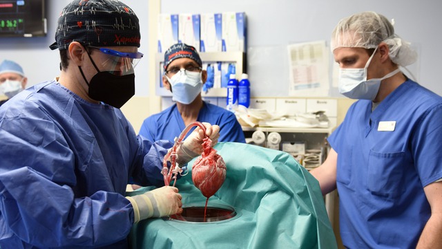 Thêm 2 người được cấy ghép tim lợn: Các bác sĩ tuyên bố sẵn sàng học hỏi từ thất bại - Ảnh 1.