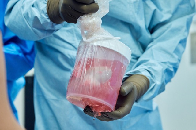 Đột phá: Các bác sĩ Mỹ ghép thận lợn sang người và ước mơ về một nguồn cung nội tạng vô tận - Ảnh 10.