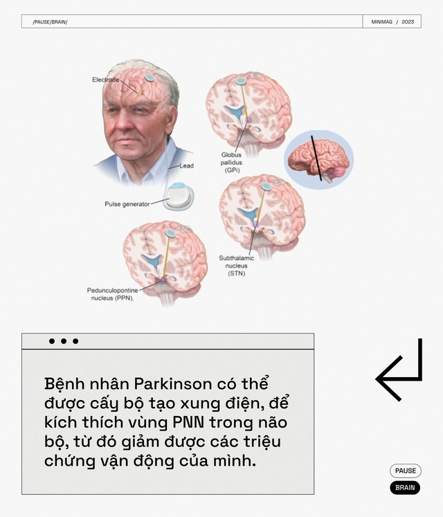 Các nhà khoa học tìm thấy một nút &quot;Pause&quot; trong não bộ, khi nhấn vào, toàn bộ cơ thể bạn sẽ bất động - Ảnh 16.