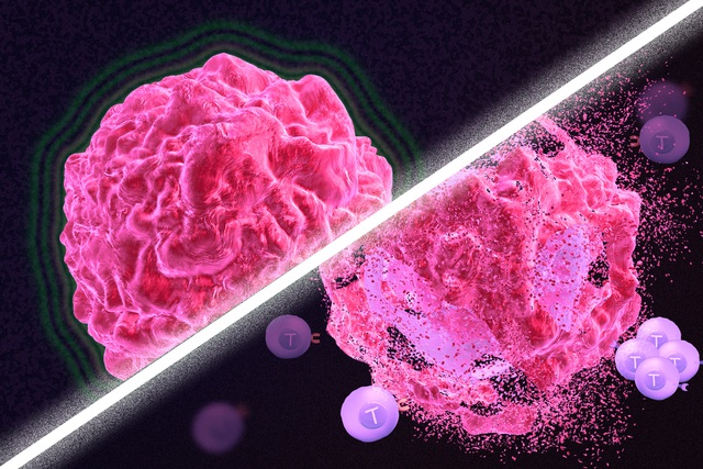 Tế bào ung thư tồn tại và phát triển trong cơ thể chúng ta như thế nào?- Ảnh 4.