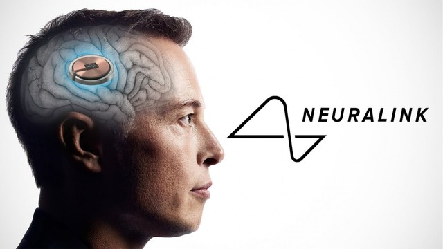 Người đầu tiên được cấy chip não Neuralink đã hồi phục, còn được bổ sung thêm "siêu năng lực" mới- Ảnh 1.