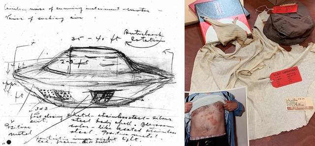 Sự kiện UFO hồ Falcon: Người đàn ông bị bỏng sau khi chạm vào UFO và dấu vết trên cơ thể không mờ đi suốt 32 năm!- Ảnh 5.