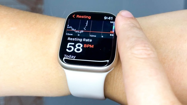 Người dùng Apple Watch sắp được trải nghiệm tính năng mà Samsung trang bị cho Galaxy Watch từ lâu- Ảnh 1.