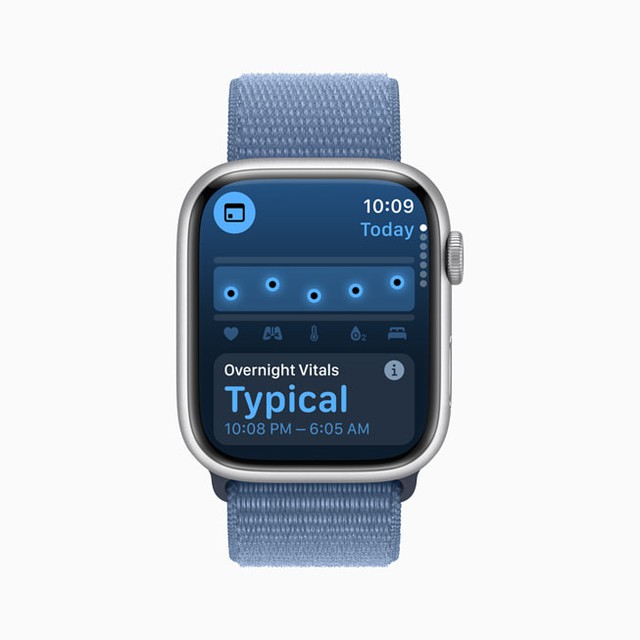 Những mẫu Apple Watch này sẽ bị Apple bỏ rơi từ ngày hôm nay- Ảnh 2.