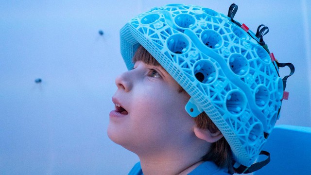 Các nhà khoa học đã đưa ra một cảnh báo khẩn cấp sau khi 250.000 bộ não được "giải mã" - Ảnh 1.