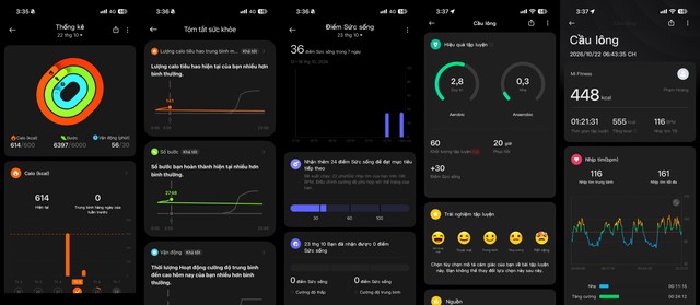 Trên tay Xiaomi Smart Band 11: Mỏng nhẹ hơn, màn hình sáng 2.000 nit, - Ảnh 10.