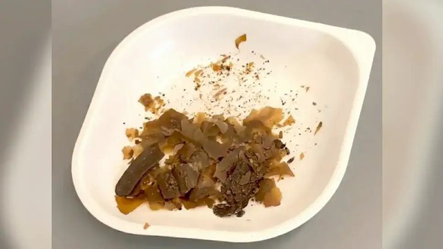 C&oacute; thể bạn chưa biết, v&agrave;o thời La M&atilde; người ta đ&atilde; sử dụng ph&acirc;n người l&agrave;m thuốc - Ảnh 2.