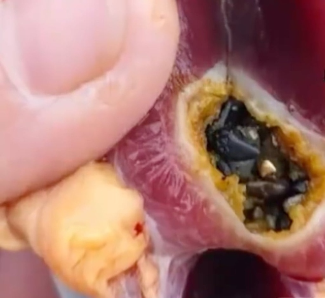 Mổ vịt phát hiện vàng thật trong dạ dày: Câu chuyện lạ ở Trung Quốc gây bão mạng xã hội - Ảnh 2.