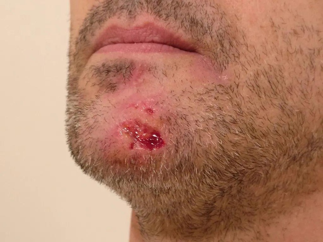 Nghiện tự làm đau: Sự tương đồng đáng sợ giữa người và vẹt khi tự nhổ lông xé da để trốn tránh các áp lực cuộc sống - Ảnh 3.