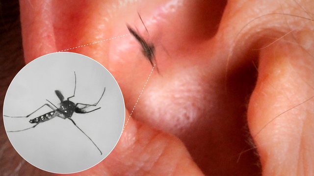 V&igrave; sao muỗi lu&ocirc;n vo ve b&ecirc;n tai con người d&ugrave; điều đ&oacute; khiến ch&uacute;ng dễ bị ph&aacute;t hiện v&agrave; ti&ecirc;u diệt - Ảnh 2.