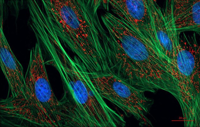 
Các tế bào fibroblast.
