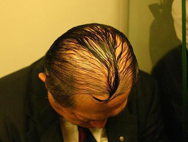 [Vui] Tuyển tập những mẫu tóc che mưa dành cho các quý ông đầu hói - Ảnh 12.