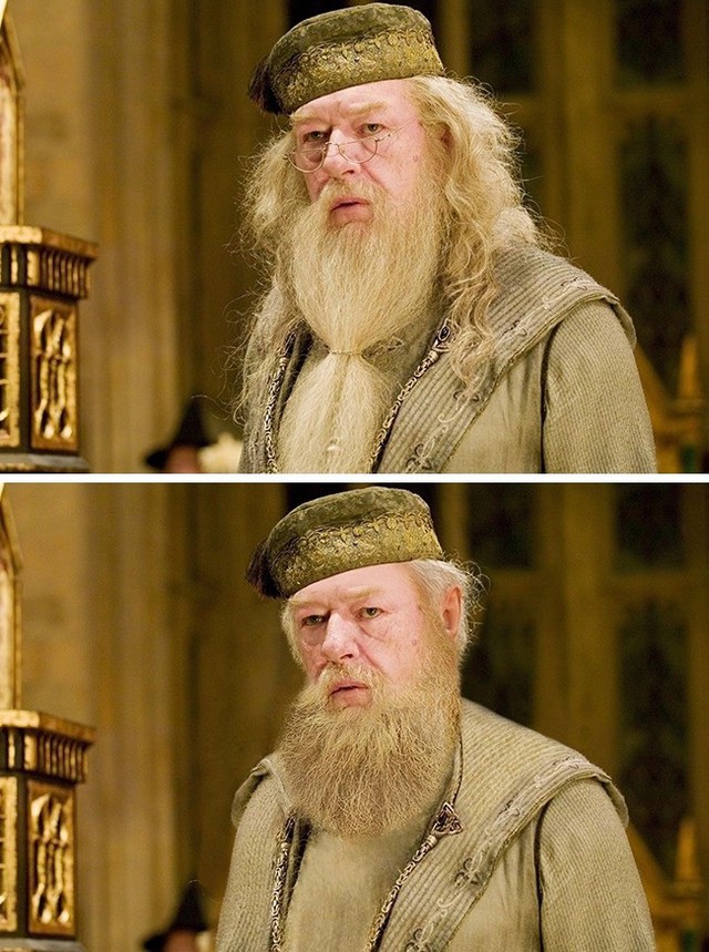 
Nhân vật Dumbledore trong Harry Potter được mệnh danh là một hiệu trưởng hiền từ với bộ râu trắng dài. Nay tóc tai với râu biến mất thì các học sinh trường Hogwarts sẽ loạn lên mất.
