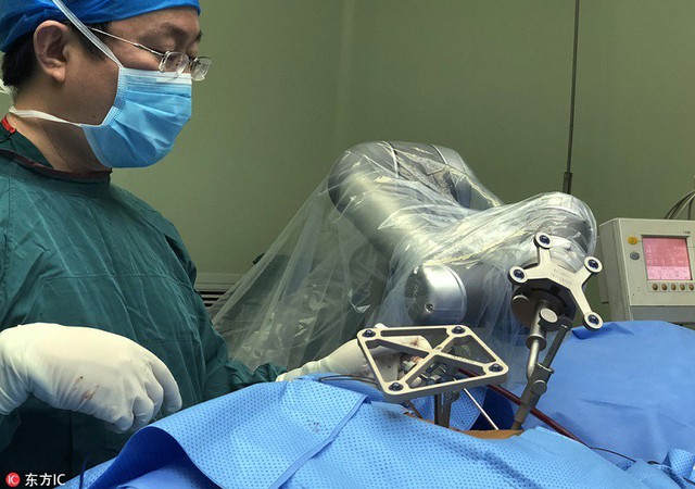 Robot Trung Quốc thực hiện ca phẫu thuật thành công trên cơ thể người, mở ra một tương lai mới cho toàn thế giới - Ảnh 3.